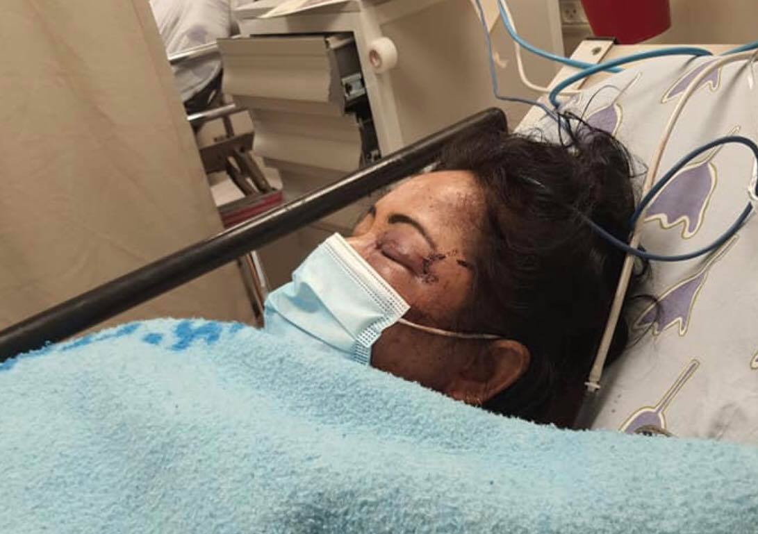 ईजरायलमा सडक दुर्घटनामा परि नेपाली महिला गम्भिर घाईते